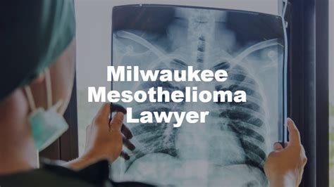 Mesothelioma Lawyer Milwaukee
